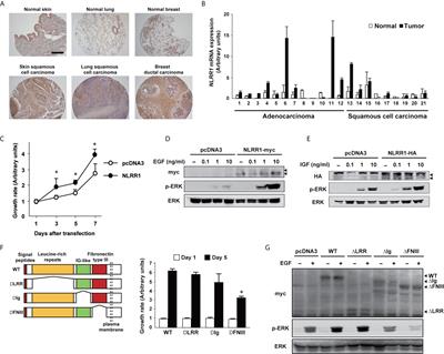 NLRR1 Is a Potential Therapeutic Target in Neuroblastoma and MYCN-Driven Malignant Cancers